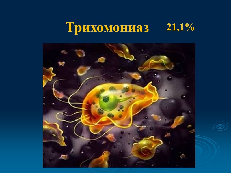 Трихомониаз  21,1%